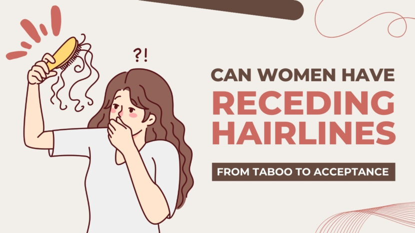 Women Receding Hairlines